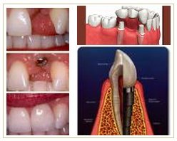 Slider image (7) Dentist Alanya